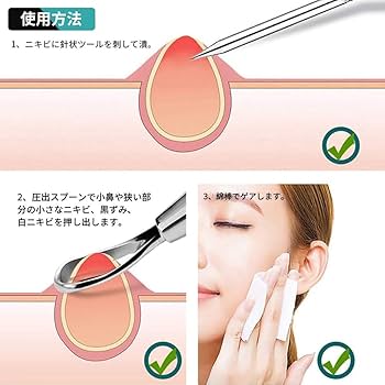 【お盆セール17日まで】コンフォートデュアル　RF たるみ　しわ　毛穴　ニキビ お盆セール17日まで】コンフォートデュアル RF たるみ しわ 毛穴